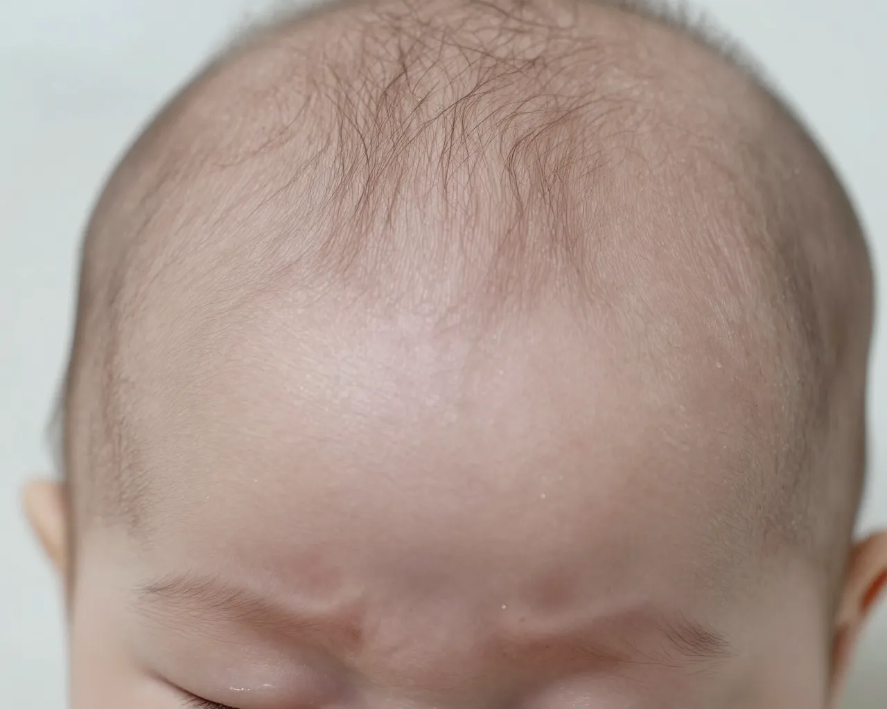 Meningitis bacteriana: la silenciosa amenaza que mata a uno de cada cinco pacientes en Latinoamérica